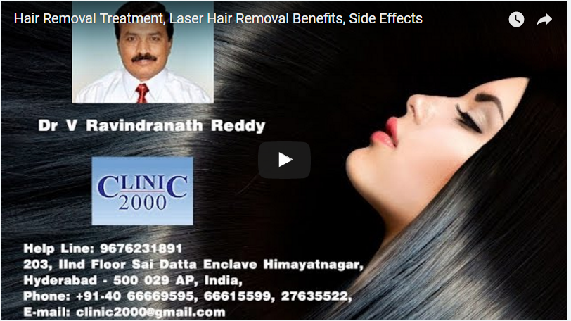 Hair Removal Treatment, Laser Hair Removal Benefits, Side Effects