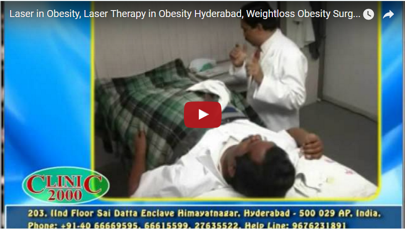 Laser in Obesity, Laser Therapy in Obesity Hyderabad, Weightloss Obesity Surgery