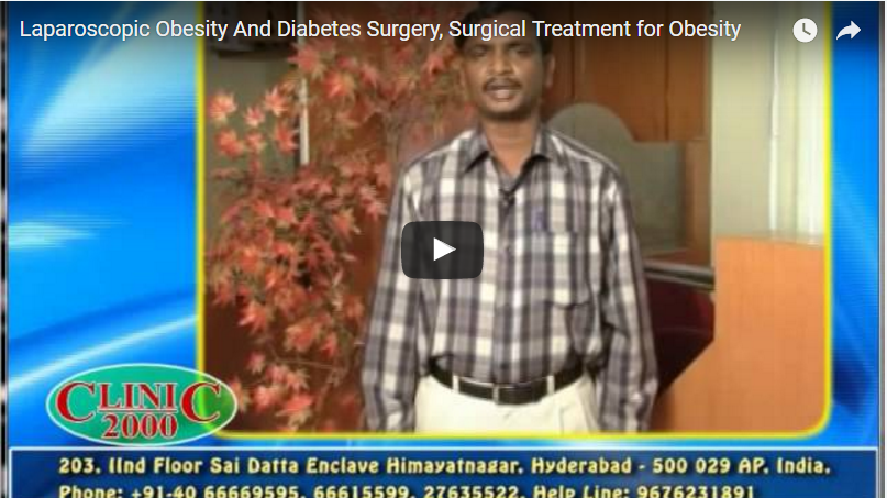 Laparoscopic Obesity And Diabetes Surgery, Surgical Treatment for Obesity