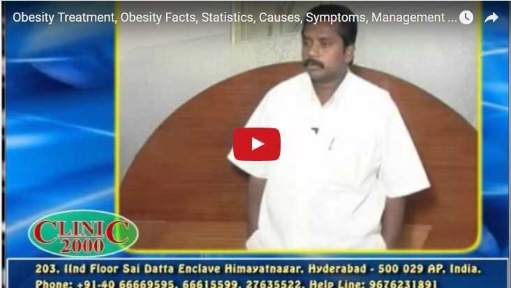 Obesity Treatment, Obesity Facts, Statistics, Causes, Symptoms, Management of obesity