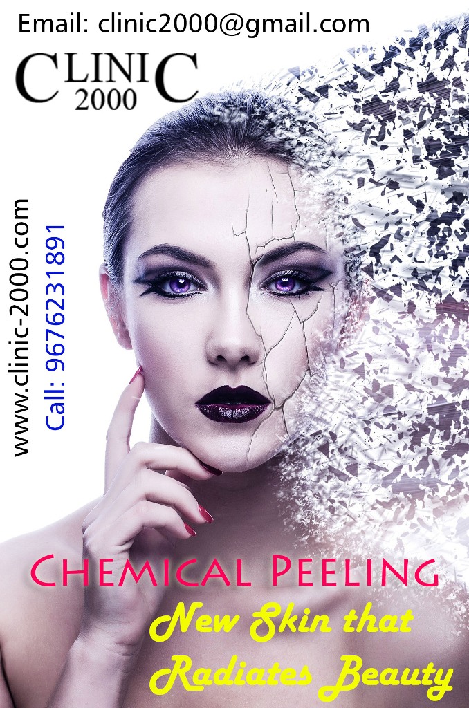 Chemical peeling