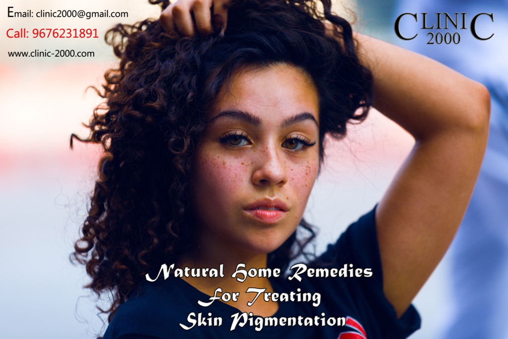Natural Home remidies for skin pigmentation