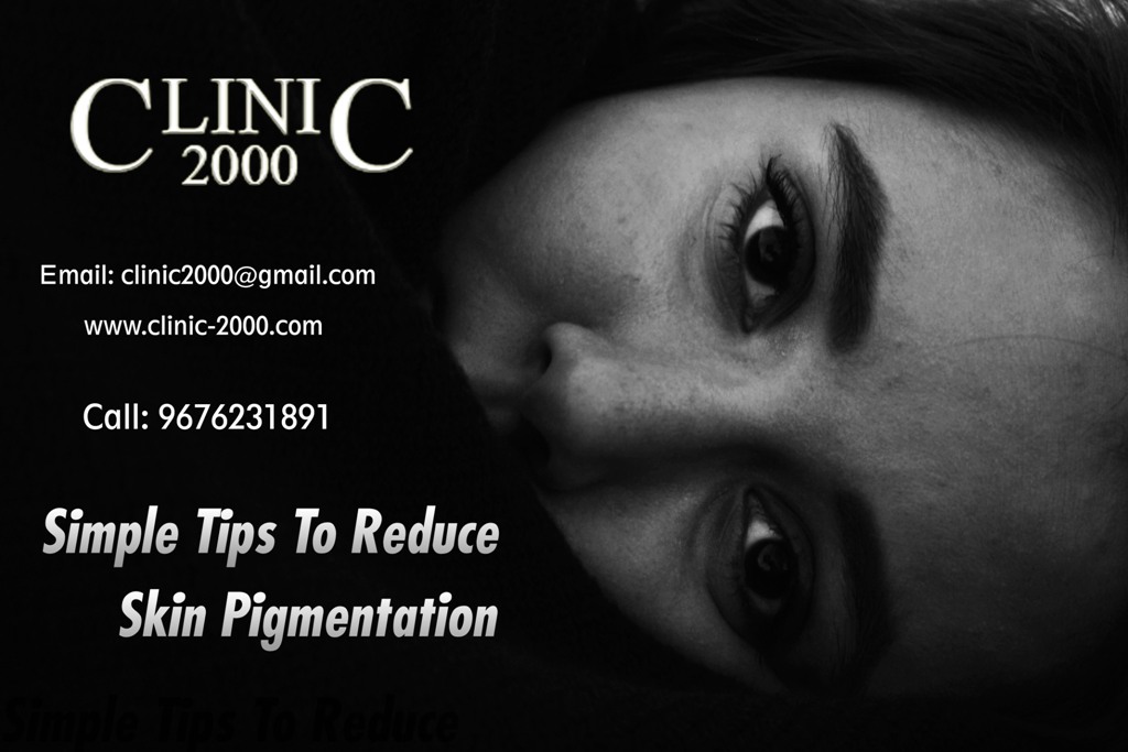 Tips for Skin Pigmentation