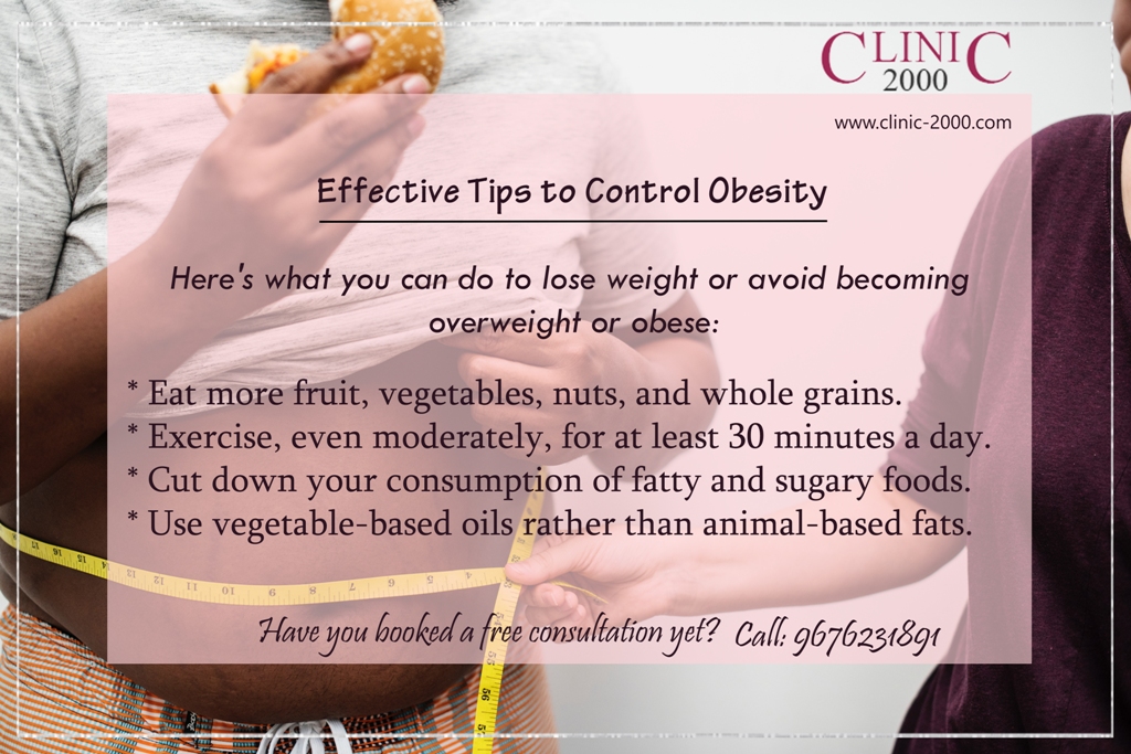 Effective Tips to Control Obesity