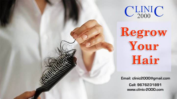Regrow Your Hair at Clinic 2000