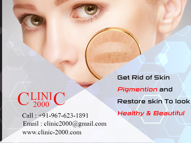 Remove  skin pigmentation at Clinic2000