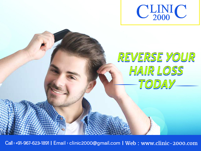 Reverse your Hairfall today at Clinic2000