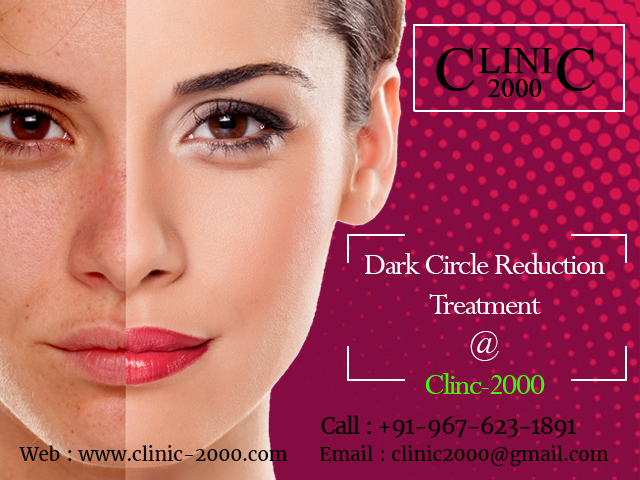 Remove Darkcircles at Clinic2000
