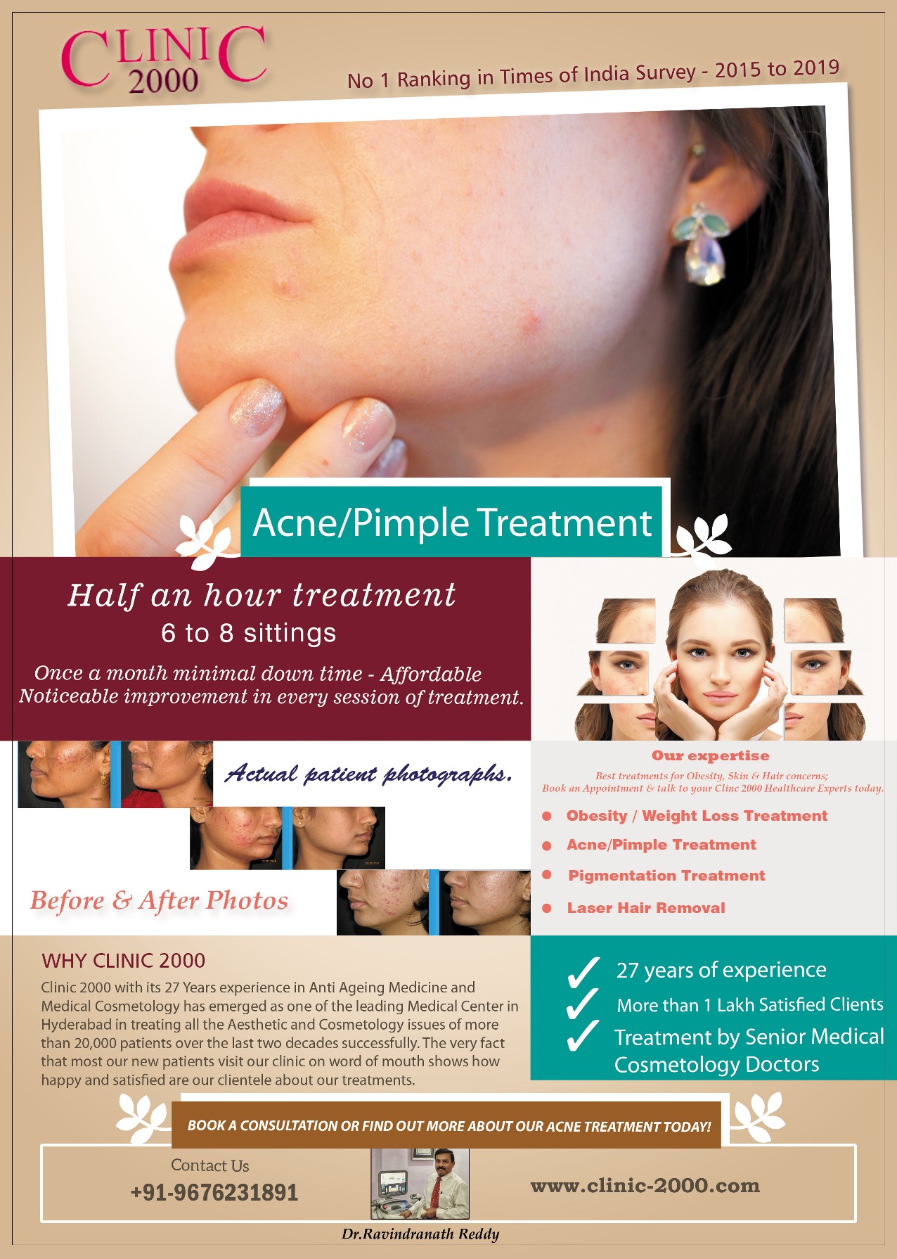 Acne Pimples Scar Treatment