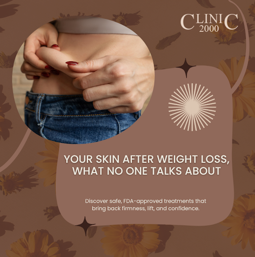 Rapid Weight Loss Face? The Truth About Weight Loss & Your Skin, What You Need to Know