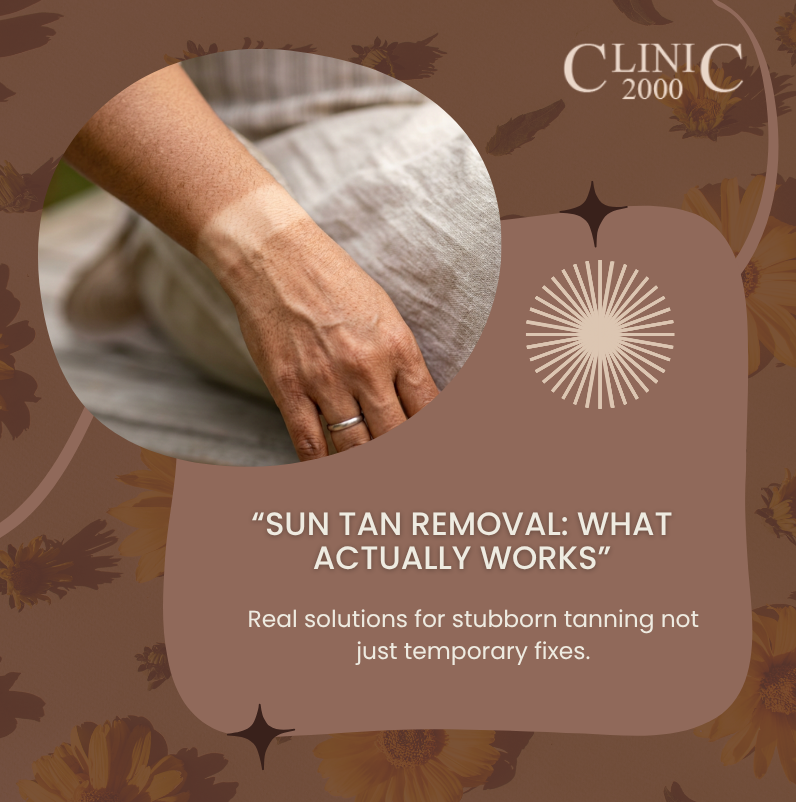 Sun Tan Removal: What Actually Works, According to Dermatologists