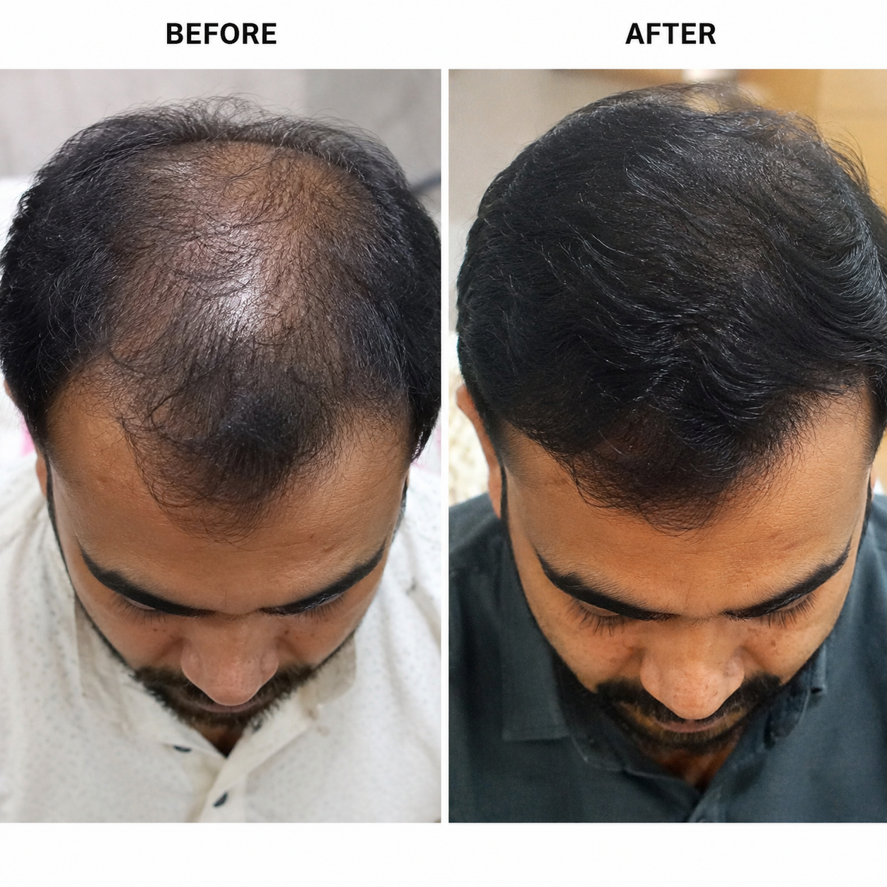 Before and after