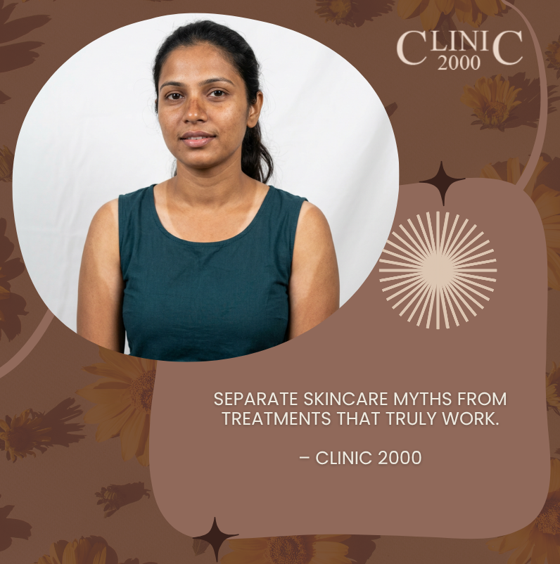 Tan Removal and Skin Brightening: What Works, What Does Not, and What Hyderabad’s Best Clinic Recommends