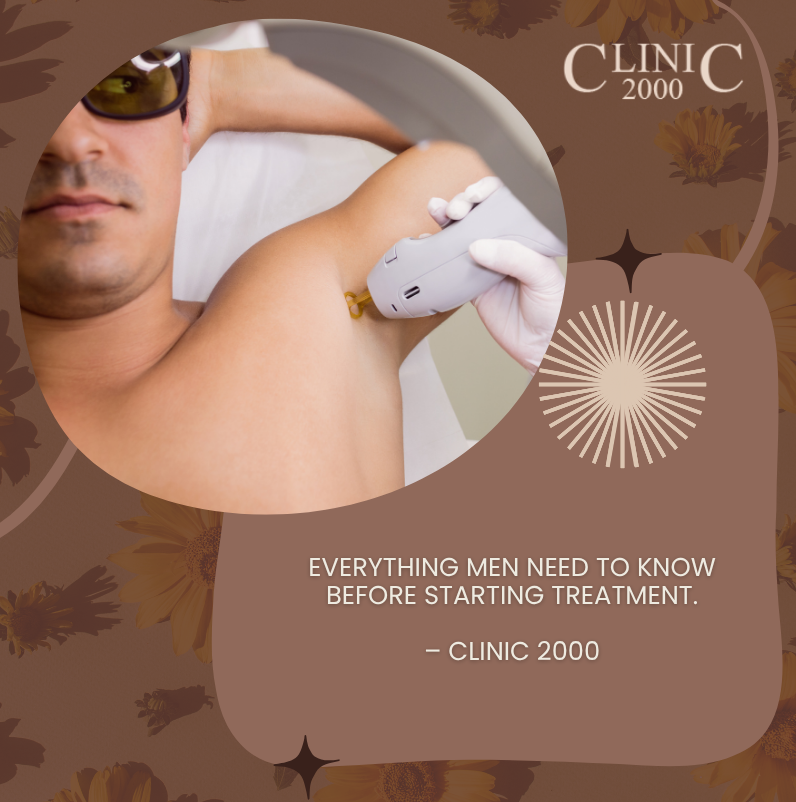 Laser Hair Removal for Men: Everything You Need to Know Before Your First Session