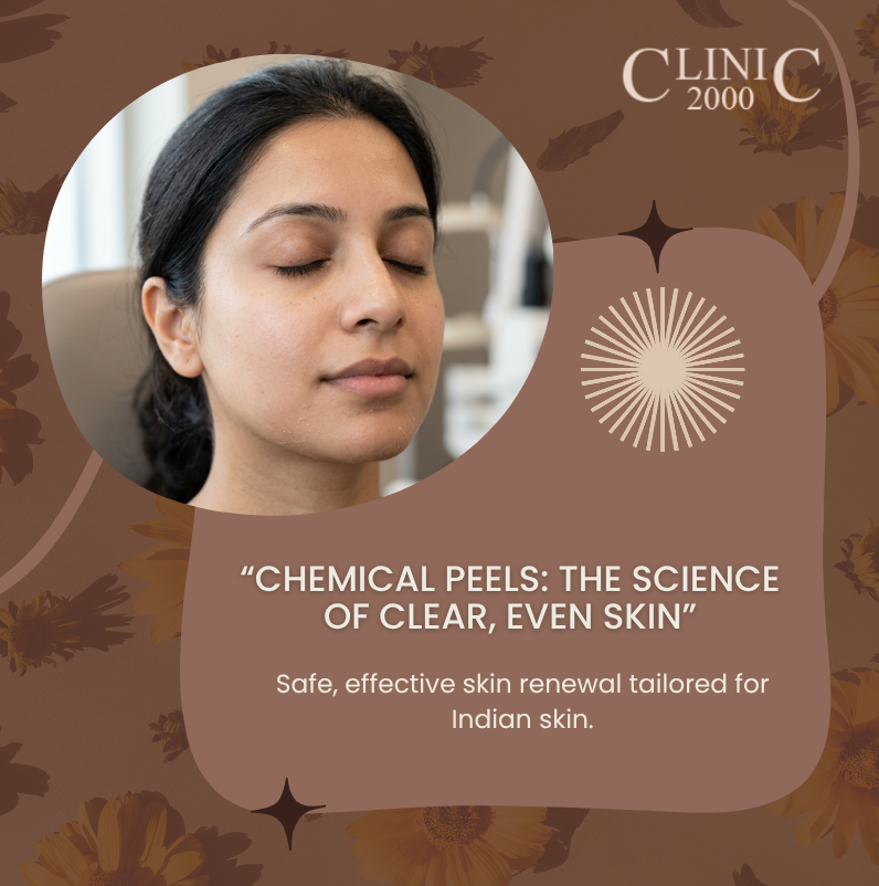 The Complete Guide to Chemical Peels for Indian Skin