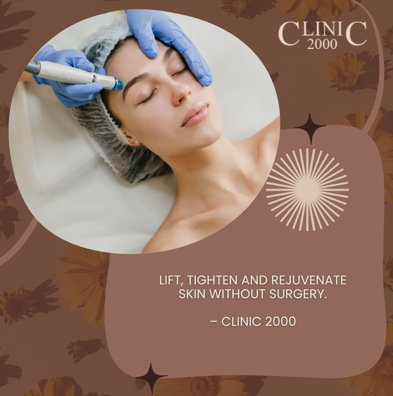 HIFU Face Lift and Skin Tightening: The Complete Non-Surgical Guide