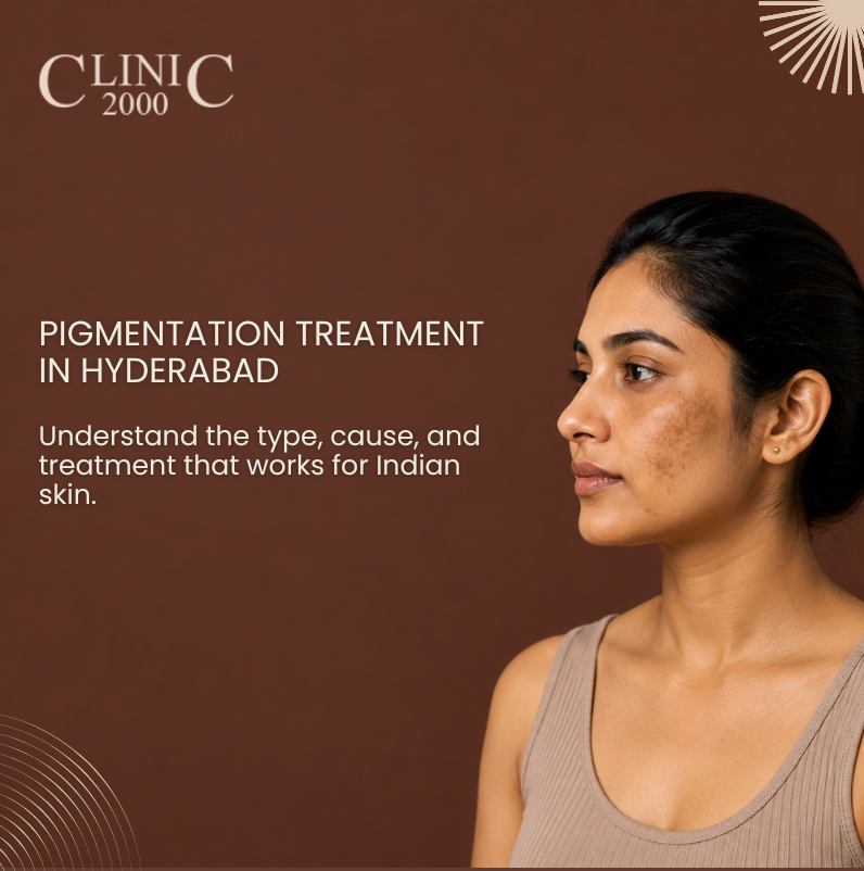 Pigmentation Treatment in Hyderabad: Types, Causes & Which Treatment Actually Works on Indian Skin