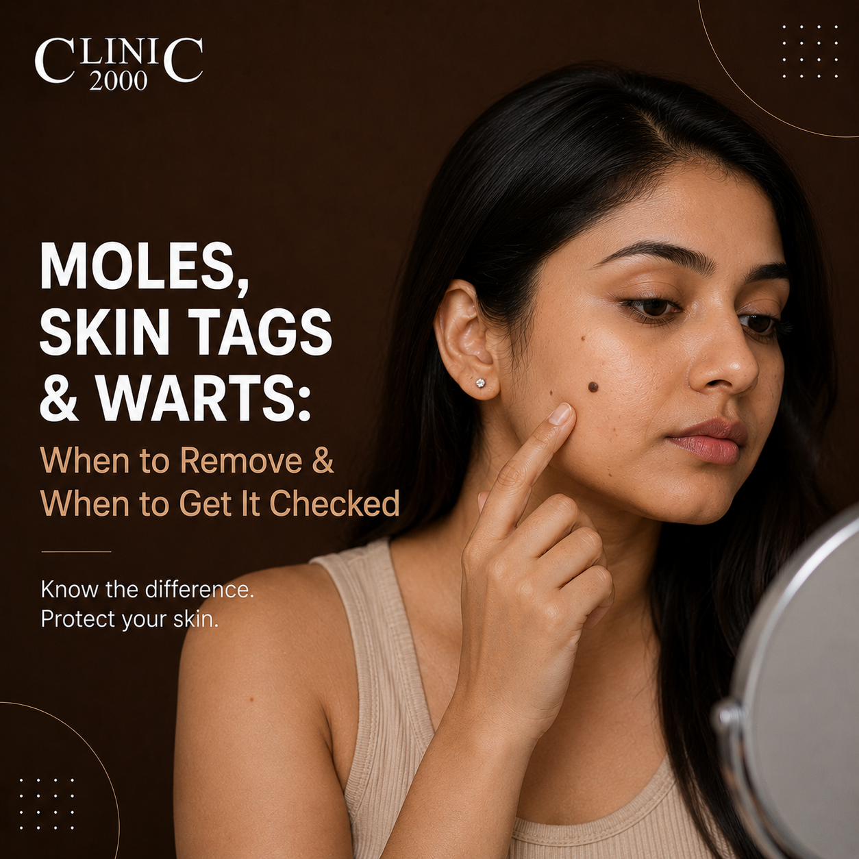 Moles, Skin Tags & Warts: When to Remove & When to Get It Checked