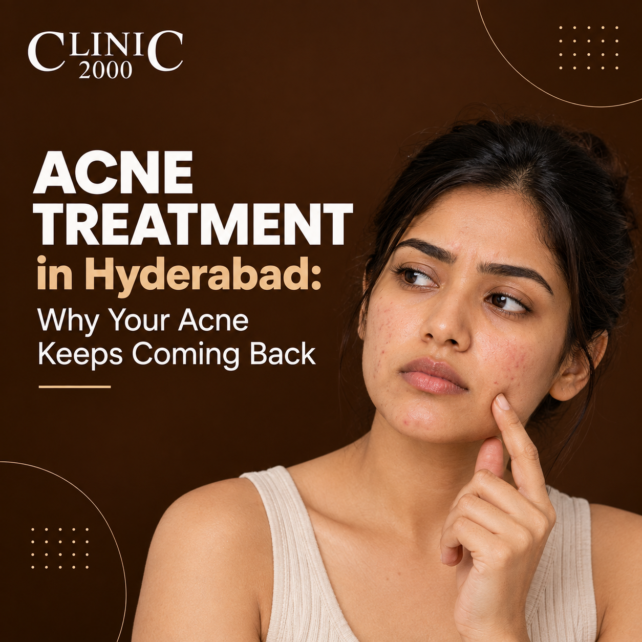 Acne Treatment in Hyderabad: Why Your Acne Keeps Coming Back