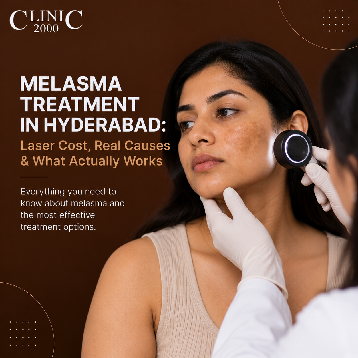 Melasma Treatment in Hyderabad: Laser Cost, Real Causes & What Actually Works